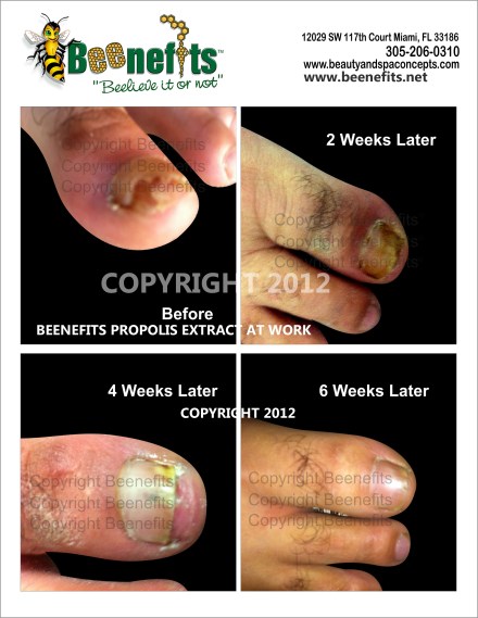 BEENEFITSFABTOE12042014