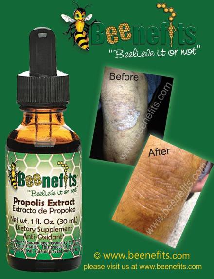 knee local chef smorai